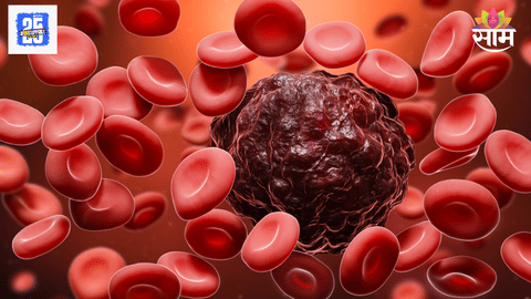 Blood cancer symptoms