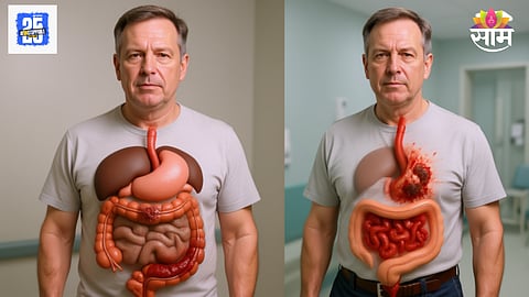 Stomach cancer symptoms