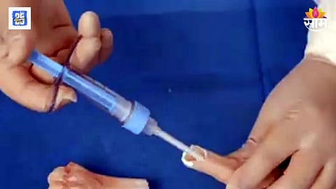 China’s bone glue dissolving naturally in six months