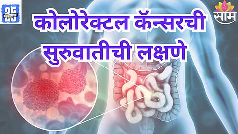 WHO cancer data