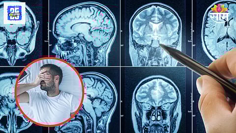 Brain aging