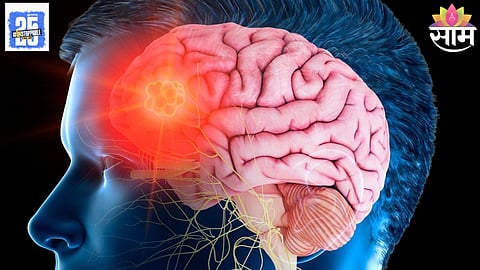 Brain Tumor Symptoms Cancer Prevention 
