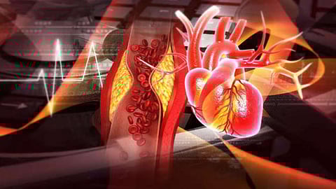 Heart Health