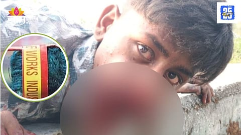 Youth Injured After Trying Dangerous Firecracker Stunt for Social Media