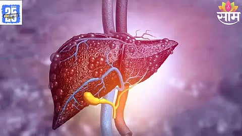 Liver Damage Symptoms