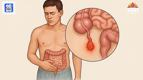 Appendix cancer on the rise in younger adults