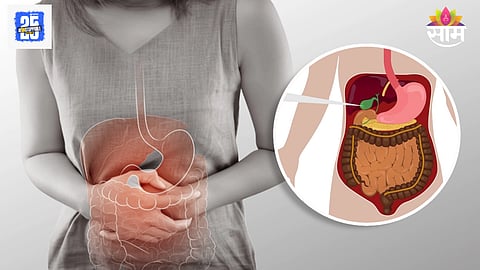 Early warning signs of gallstones