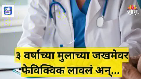 Shocking : चिमुकल्याच्या जखमेवर टाक्यांऐवजी लावलं फेविक्विक, डॉक्टरचं भयंकर कृत्य, नेमकं काय घडलं?