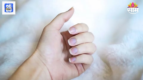 Deficiency fingers blue