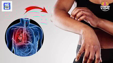 skin cancer symptoms risk precautions