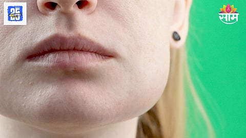 Body signals face swelling explained