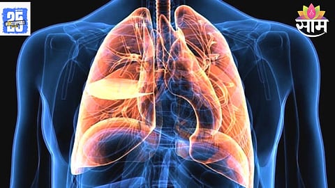 Lung Cancer Symptoms 