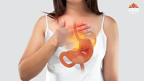 Remedies for stomach acidity