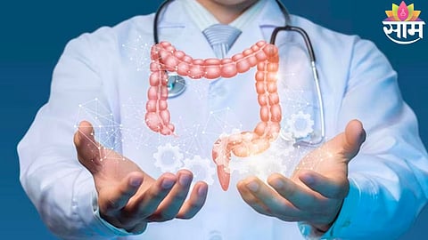 Colorectal Cancer Risk