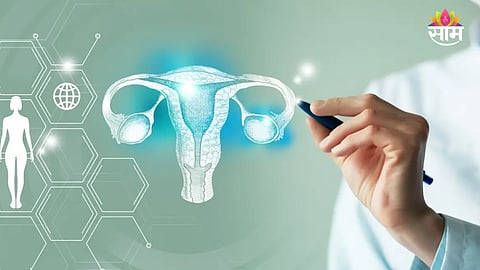 Ovarian cancer misconceptions