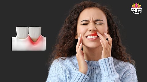 Tooth pain without cavity