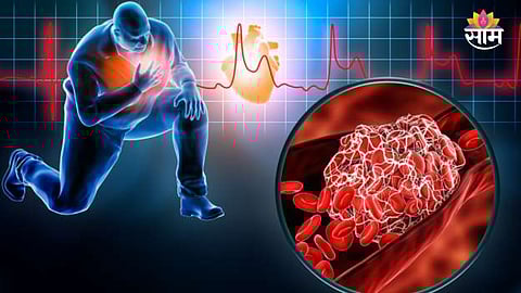 What Are the Signs of a Heart Attack 48 Hours Before