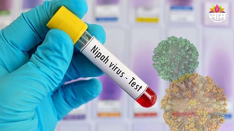 Nipah virus symptoms