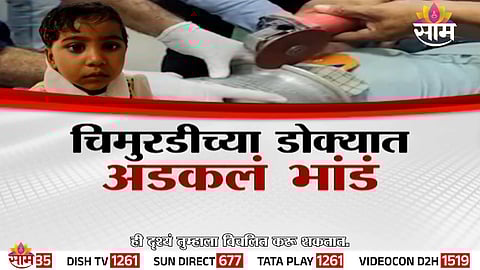 Doctors and a local plumber successfully rescue a 2-year-old girl after an aluminum pot got stuck on her head in Jalgaon