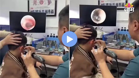 Screw stuck near eardrum in child