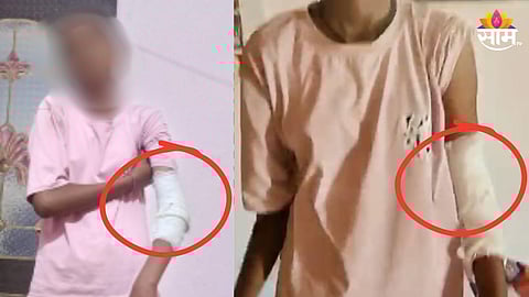 Nagpur : गणित चुकलं म्हणून विद्यार्थिनीला बेदम मारहाण, शिक्षकांची पालकांनाही धमकी,  जिल्हा परिषद शाळेतील धक्कादायक घटना