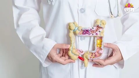 What Are The Early Signs Of Colon Cancer