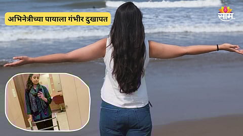 Famous Actress Leg Injury