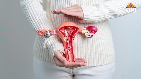 Endometriosis symptoms