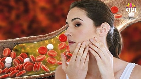 Cholesterol signs on face