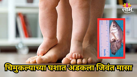 Shocking : ...अन् १ वर्षांच्या मुलाच्या घशात अडकला जिवंत मासा; पालकांची एकच धावाधाव, नेमकं काय घडलं?