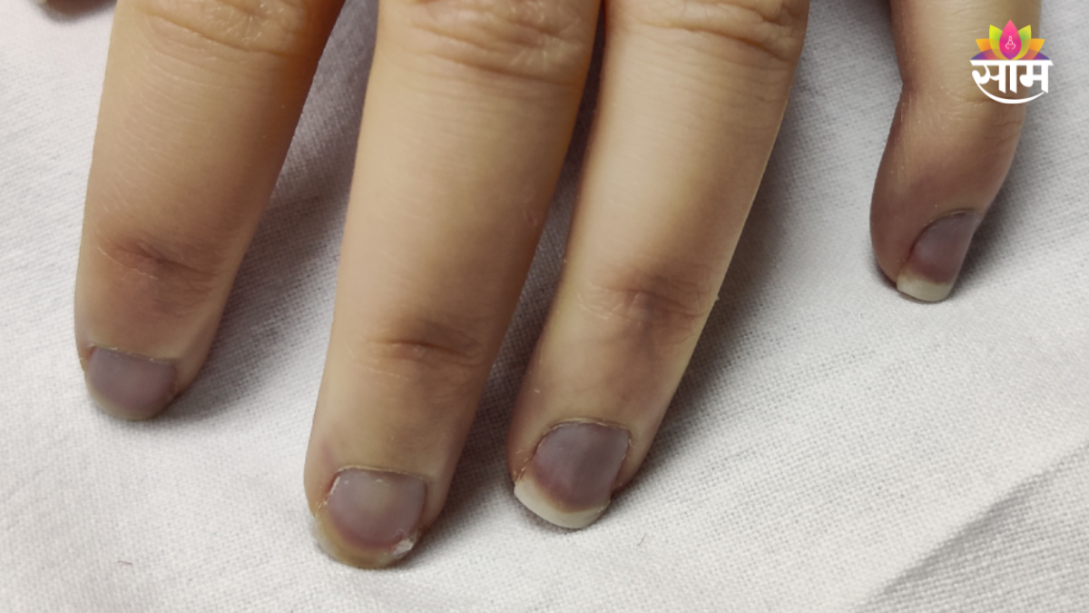 Health warning signs