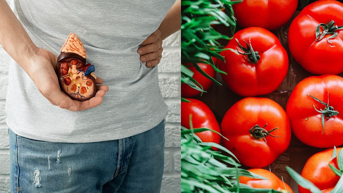 Tomato Side Effects स्टोन आणि डायरिया असलेल्यांनी चुकूनही खाऊ नका
