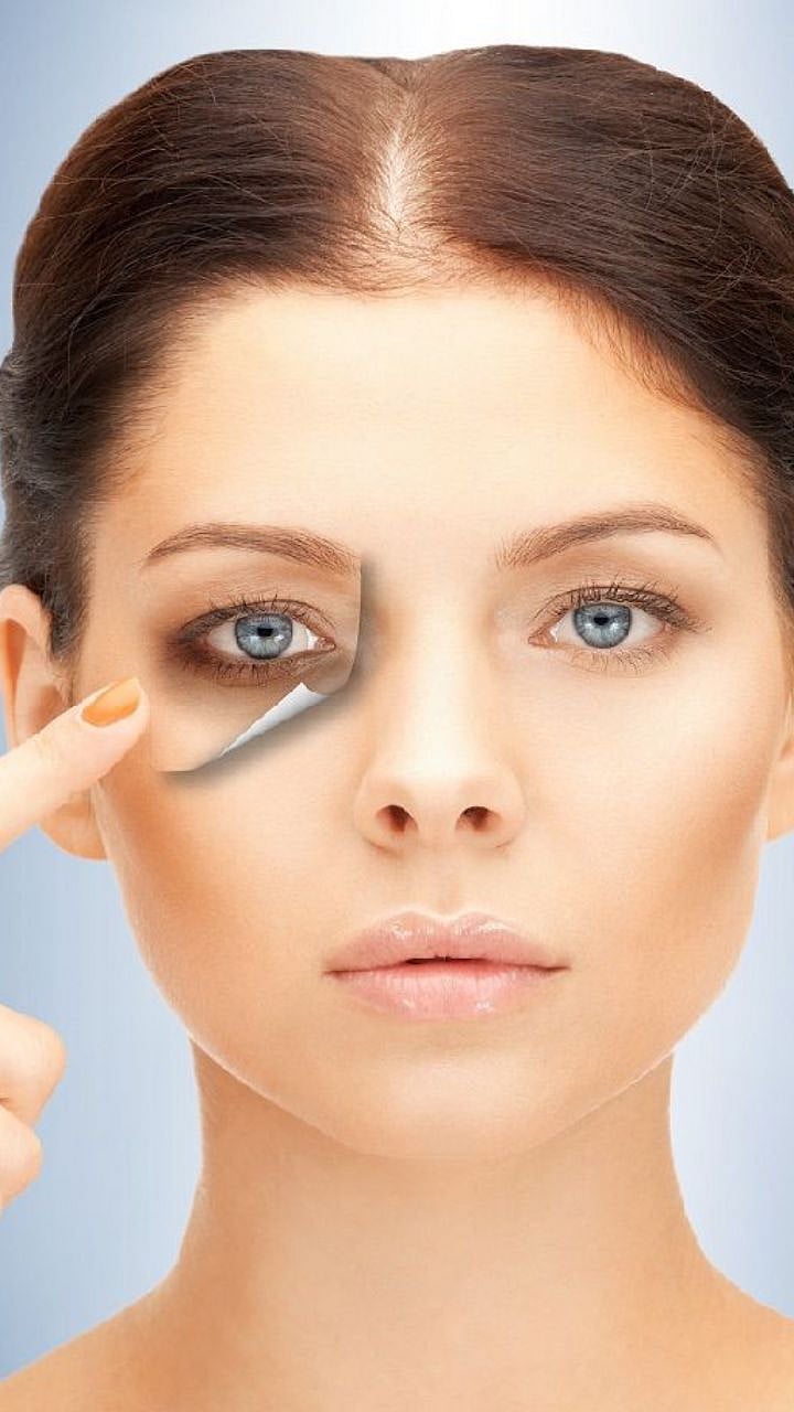 जास्त झोपल्यानेही होतात का Dark Circles? Does sleeping too much cause