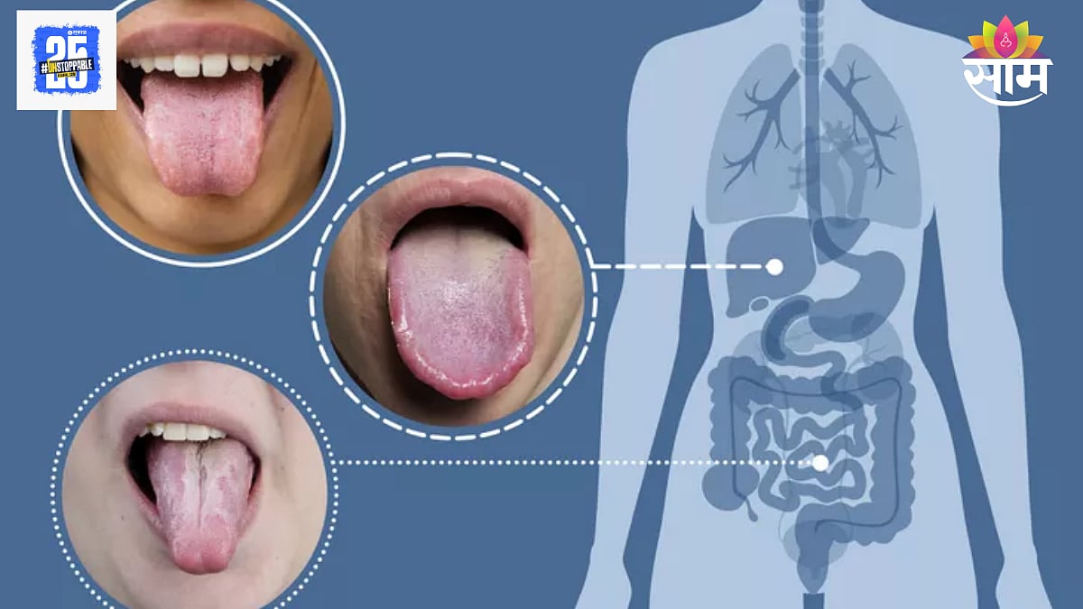 Tongue color and health: गुलाबी, लाल की पांढरा...पाहा तुमच्या जीभेचा ...