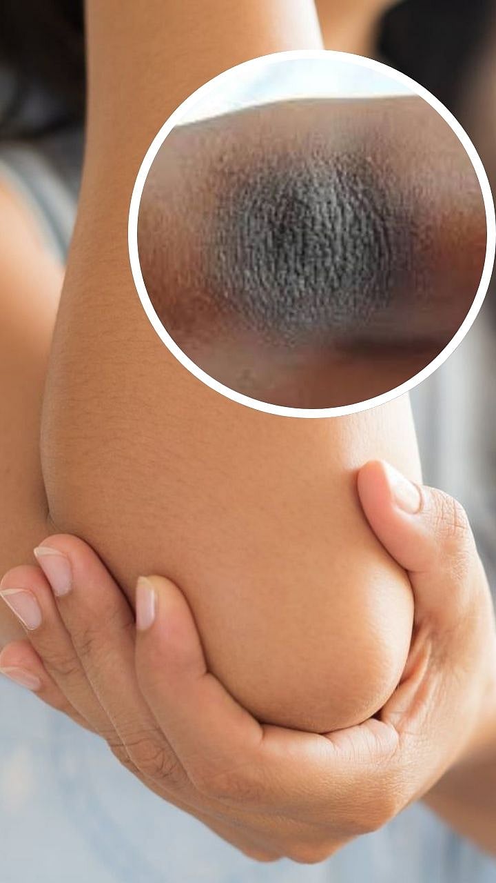 Eye Yoga Exercise: चष्मा कधीच लागणार नाही, घरीच करा हे 5 योगा 8 21 Online Maharashtra