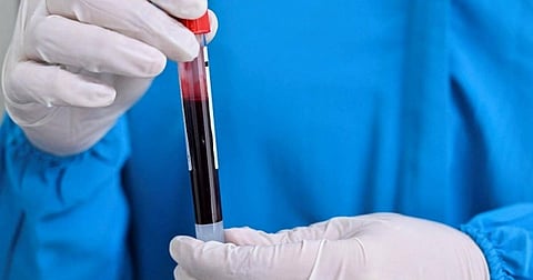 الكأس المقدسة.. فحص جديد يرصد 50 نوعًا من السرطان قبل ظهورها