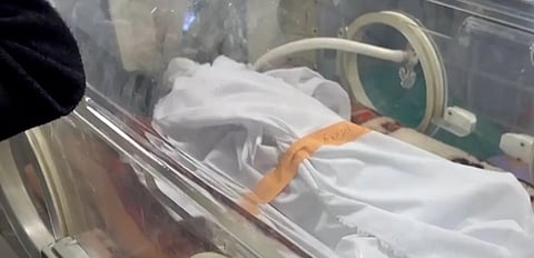  ارتفاع وفيات الجفاف في صفوف الأطفال بمستشفى كمال عدوان شمال غزة إلى ٢١ طفلاً