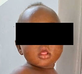 بعد 6 ساعات تحت التراب.. كيف نجت مولودة دفنتها أمها في أوغندا