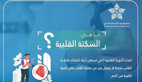 احتشاء عضلة القلب.. تعرّف على السكتة القلبية وأعراضها