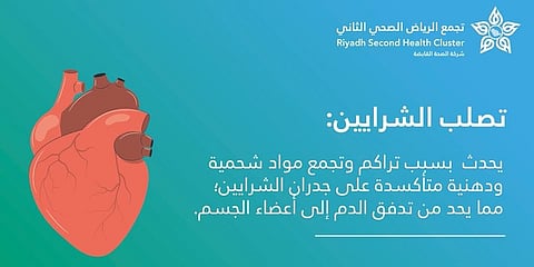"فهد الطبية": ارتفاع الكوليسترول والسمنة من عوامل الخطورة للإصابة بتصلب الشرايين