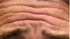 3 أخطاء شائعة تسرّع ظهور التجاعيد العميقة و5 نصائح للوقاية منها