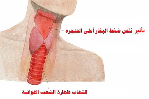"الحرارة والجفاف والغشاء المخاطي البشري".. دراسة: الاحتباس الحراري يزيد خطر التهاب الشعب الهوائية