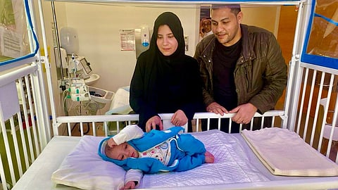 نقل التوأم الطفيلي المصري محمد عبدالرحمن جمعة إلى مستشفى الملك عبدالله  التخصصي
