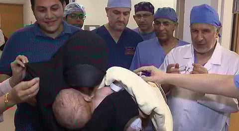 الطفل "محمد" بين يدي والدته.. شاهد لحظات إنسانية بعد نجاح فصل التوأم الطفيلي المصري 
