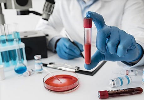 دراسة أمريكية: خفض مستويات الرصاص يحسن ضغط الدم وصحة عضلة القلب