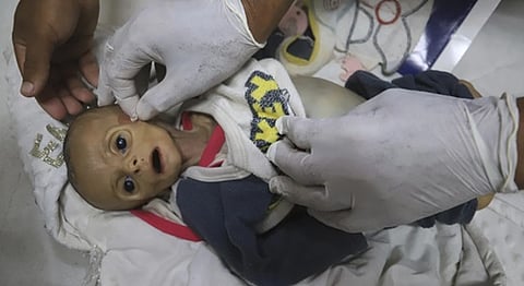 "زينب الملكة".. "أسوشيتد برس": آخر طفلة ماتت من الجوع في غزة.. وزنها لحظة موتها أقل مما كان عليه عند ولادتها