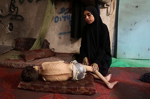 "يتطلب استجابة عالمية متكاملة".. الأمم المتحدة: سيناريو أسوأ حالات المجاعة يتكشف في غزة