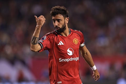  البرتغالي برونو فرنانديز