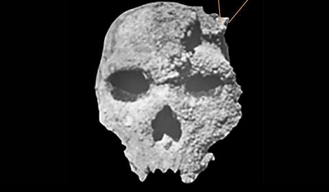 بعد 60 عامًا من الغموض.. كشف هوية صاحب "جمجمة الوحش"