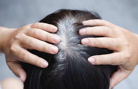 جدل طبي في الصين بعد حقن مثيرة للجدل تدّعي قدرتها على إخفاء الشيب